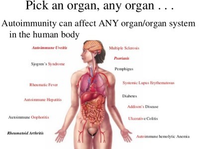 Autoimmun betegségek