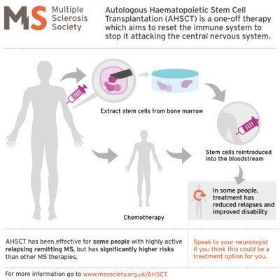 Az Autoimmun betegségek, mint a szklerózis multiplex őssejt-terápiája - Cord Blood Center Group